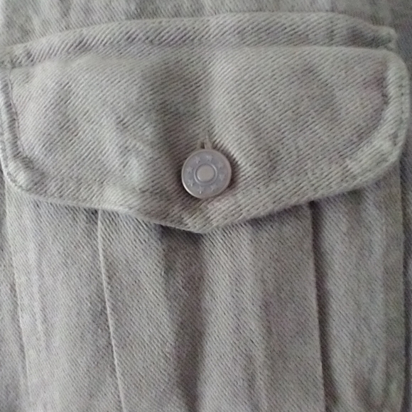 Loosing weight - Picture 6 of 9